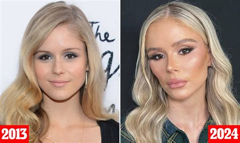 erin moriarty before surgery|Plastic surgeon reveals procedures Erin Moriarty has had